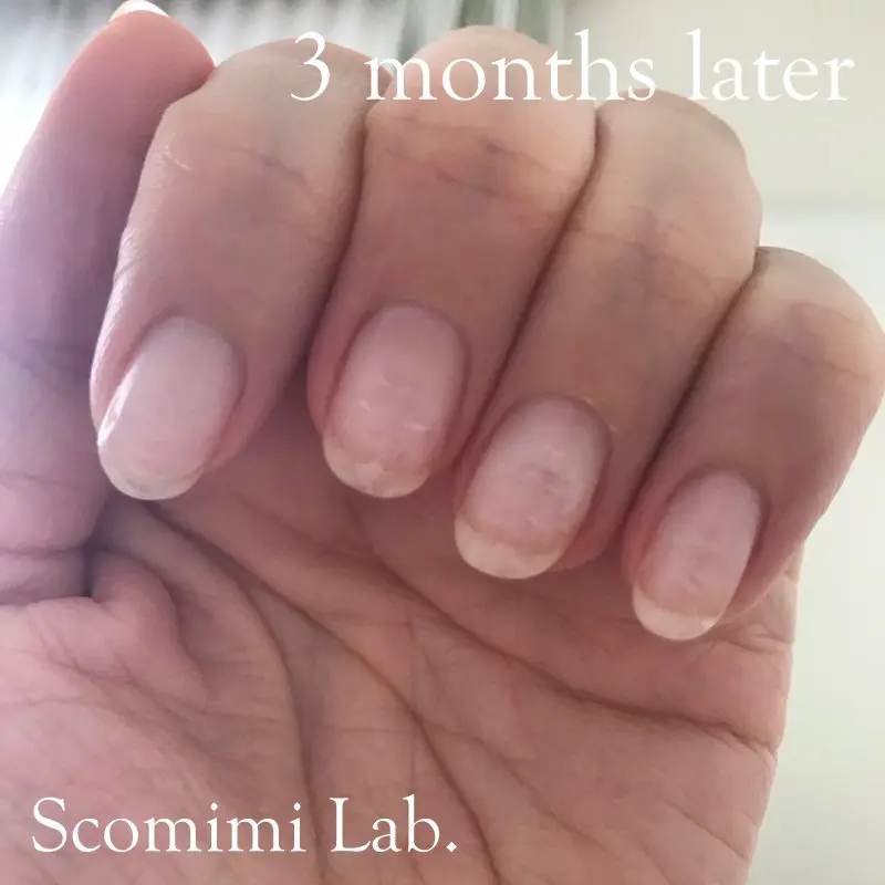 爪のピンクの部分を伸ばす方法 50歳が３か月で美爪になったネイルケアを解説 コスメとメイクの研究室 すこみみlabo